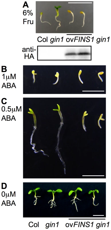 FINS1 in fructose signaling acts downstream of ABA signaling.