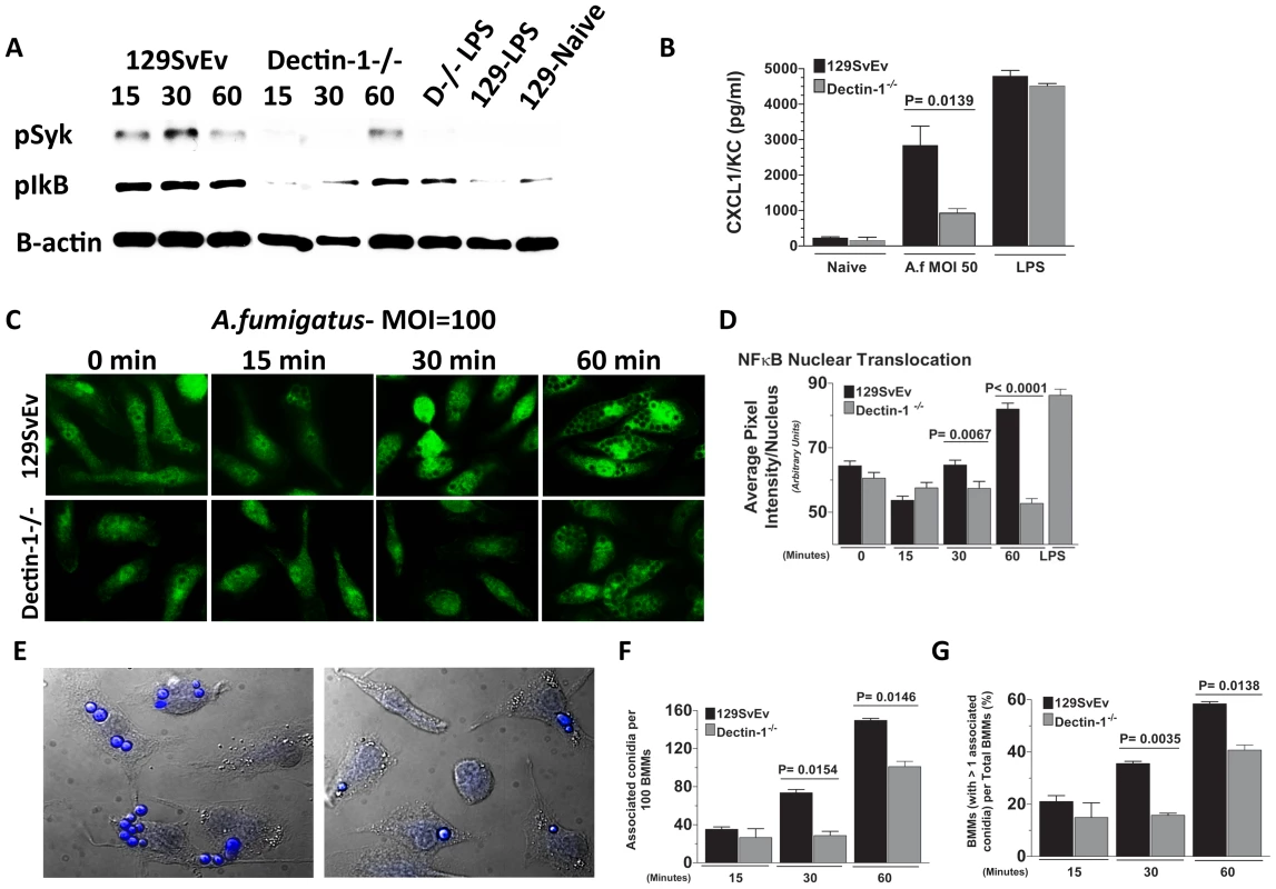 Role of Dectin-1 in activation of bone marrow-derived macrophages.