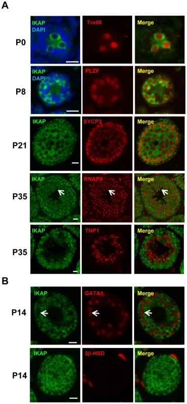 Germ cell-specific expression of IKAP during spermatogenesis.