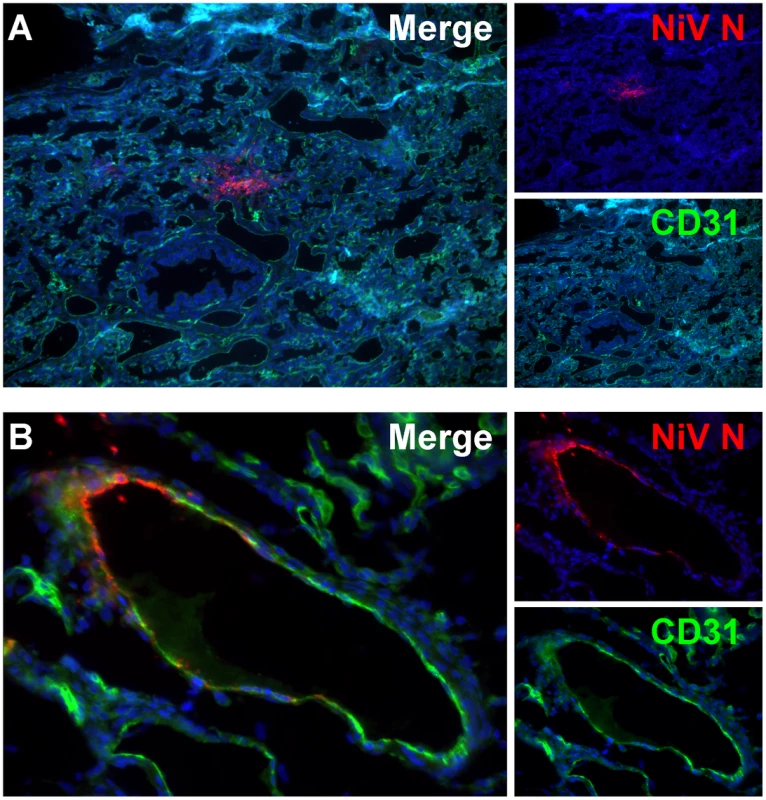 Cell tropism of Nipah virus in human lung xenografts.