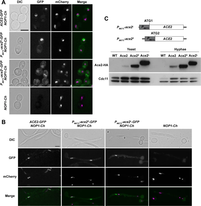 Localization of Ace2 in yeast and hyphae.