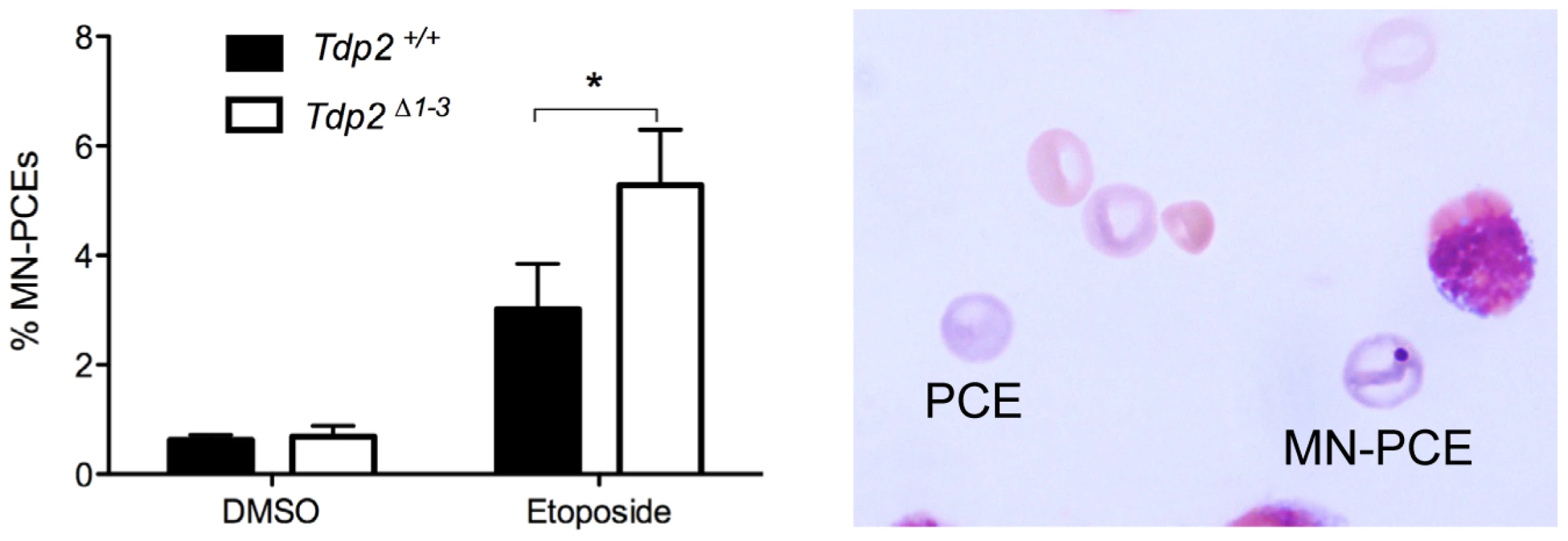 The absence of TDP2 increases etoposide-induced genome instability <i>in vivo</i>.