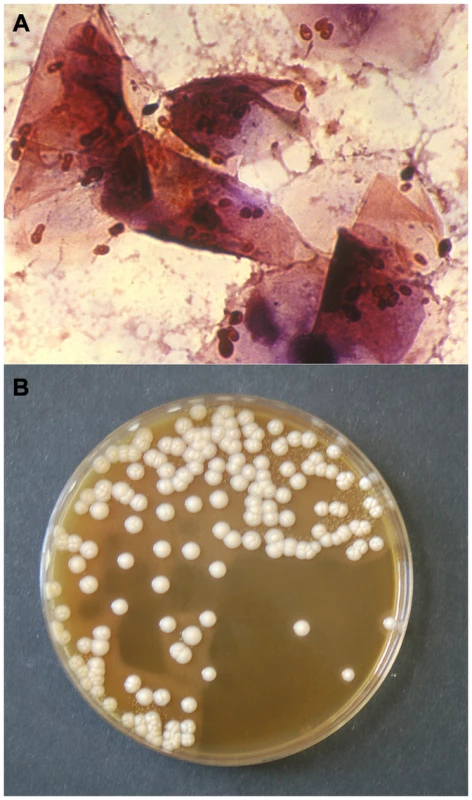 Gram stain of a smear (A) and culture (B) from an otic swab of a dog with otitis externa, showing numerous <i>M. pachydermatis</i> cells (A) and colonies (B).