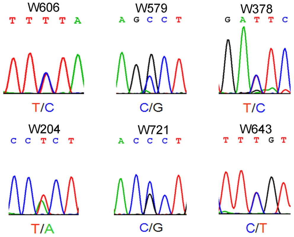 Electropherogram showing single-nucleotide mutation of &lt;i&gt;WT1&lt;/i&gt; in patients with non-obstructive azoospermia.