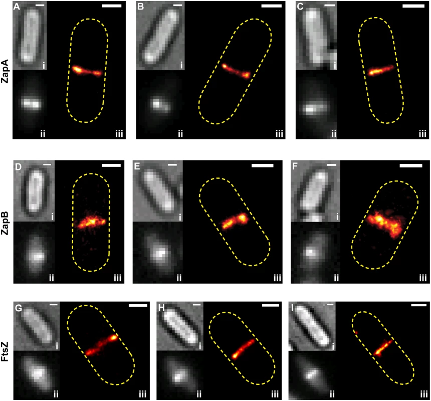 Live-cell PALM imaging of band-like ZapA, ZapB and FtsZ structures.