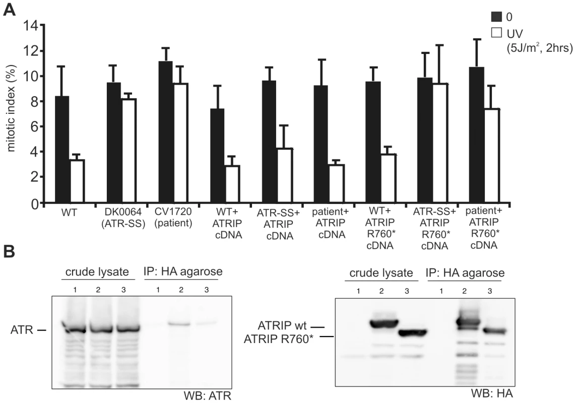 WT ATRIP cDNA but not cDNA encoding p.Arg760* ATRIP complements the G2/M checkpoint defect in CV1720 cells, and p.Arg760*ATRIP impairs ATR–ATRIP protein interaction.