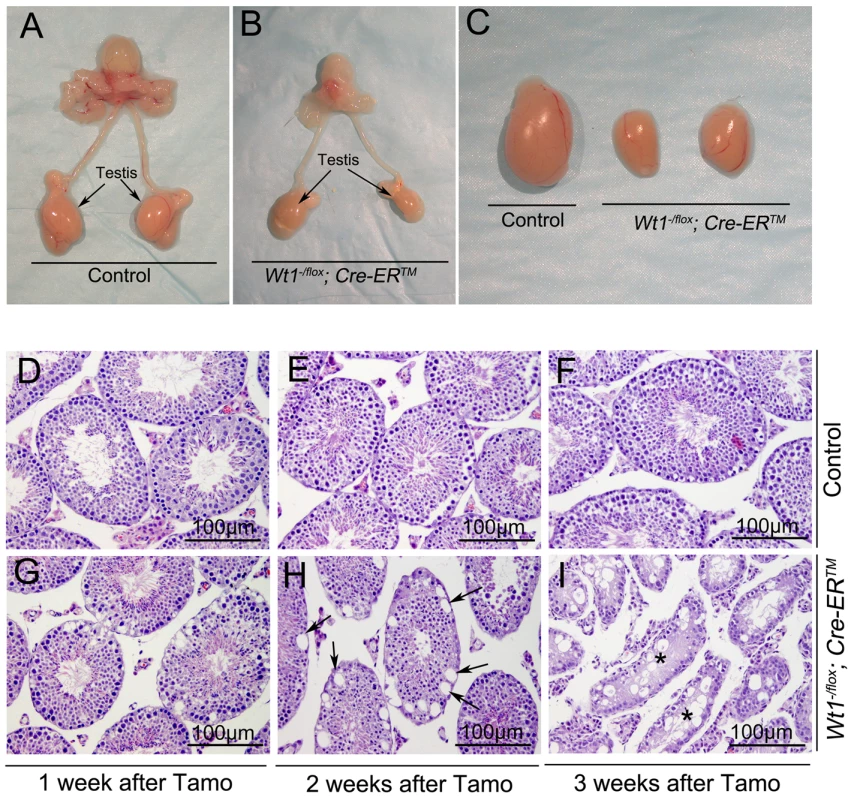 Inactivation of <i>Wt1</i> results in seminiferous tubule atrophy and testis hypoplasia.