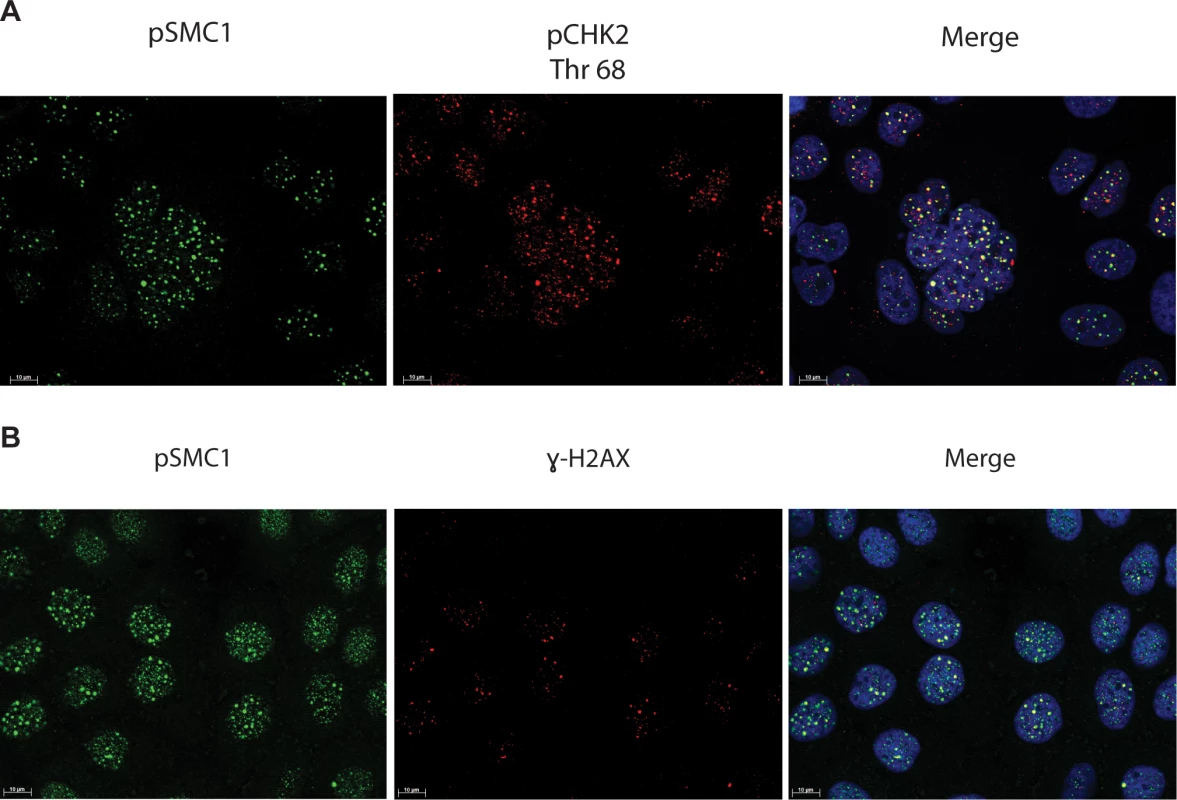 pSMC1 and pCHK2 as well as pSMC1 and γ-H2AX co-localize in distinct foci in nuclei of HPV positive cells following differentiation.