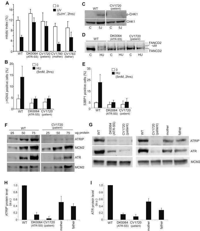 CV1720 cells show impaired ATR–dependent DNA damage responses.