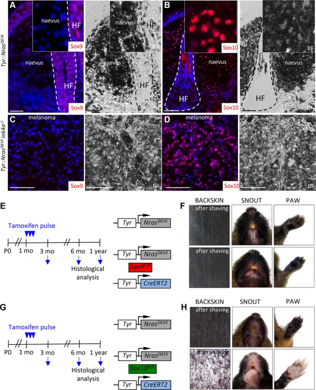 Mouse giant congenital naevi and melanoma reveal no expression of Sox9.