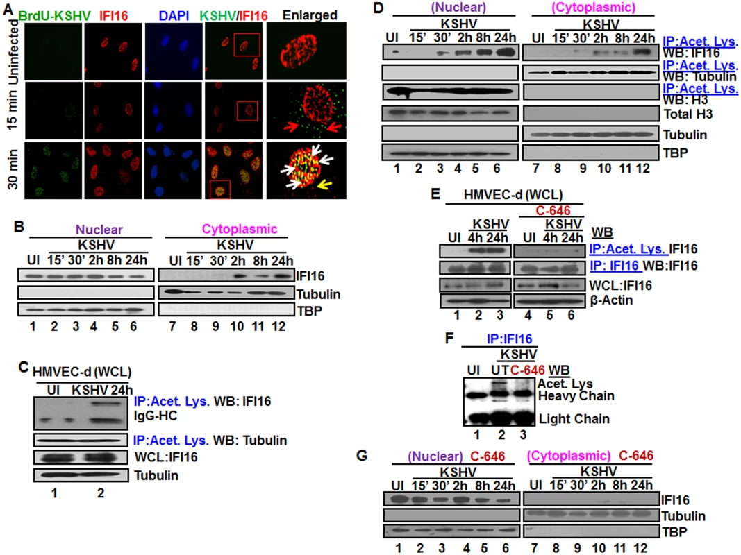Colocalization of IFI16 with BrdU genome labeled KSHV in the nucleus, acetylation of IFI16 in the nucleus and cytoplasmic redistribution during <i>de novo</i> KSHV infection of HMVEC-d cells.