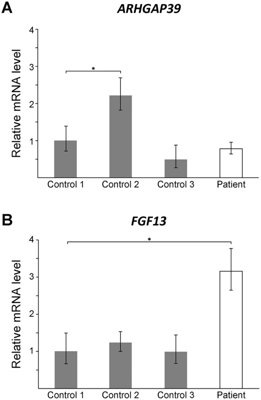 <i>FGF13</i> mRNA expression is elevated in patient lymphoblasts.