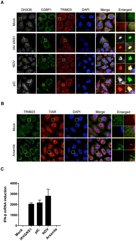 TRIM25 co-localizes with SG by virus infection or pIC transfection.