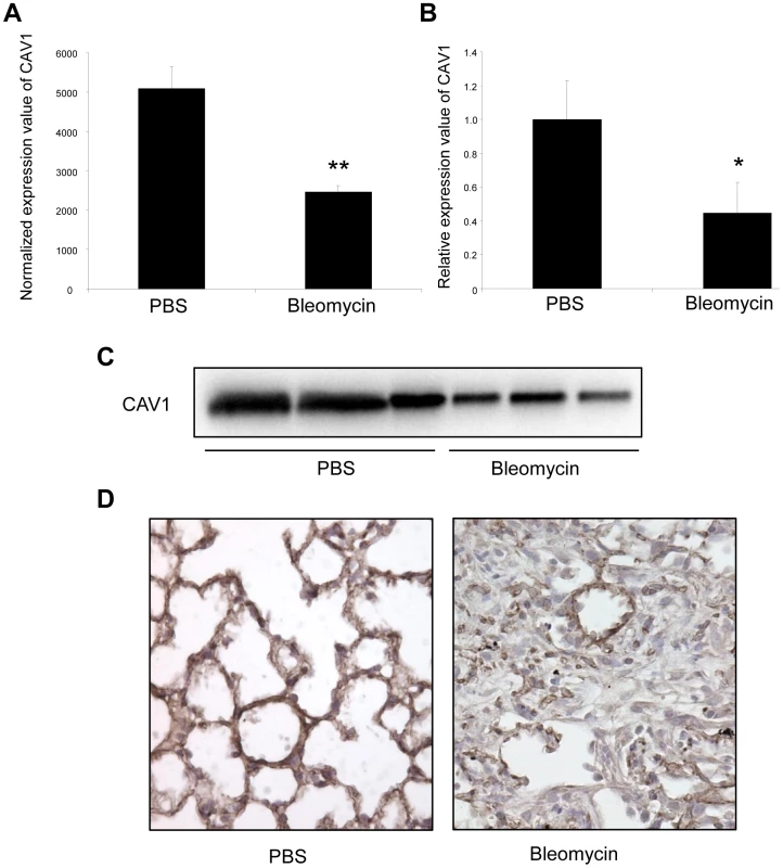 Altered CAV1 expression in bleomycin induced lung fibrosis mouse model.