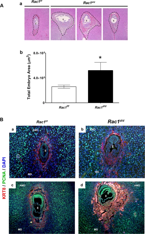 Enhanced trophoblast proliferation in <i>Rac1</i> conditional-knockout mouse.