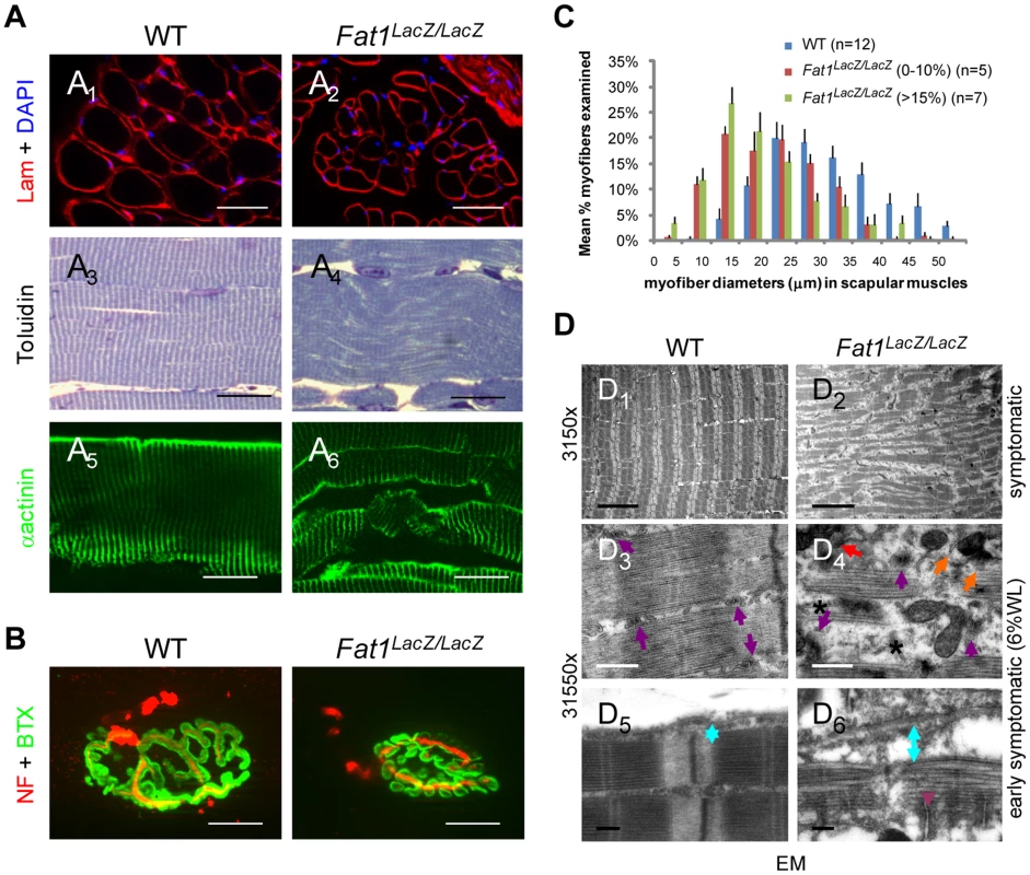 Abnormally shaped shoulder muscles of <i>Fat1</i>-deficient mice develop phenotypes involving reduced muscle fibres diameter and structural abnormalities.